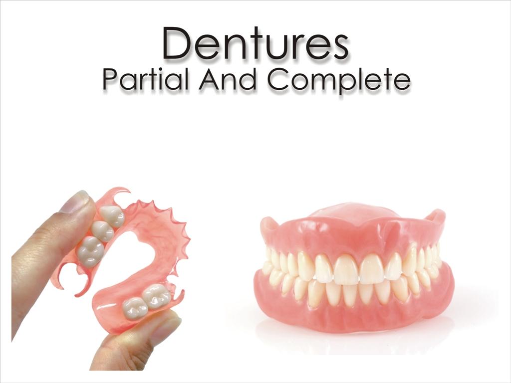 Removable Partial/Complete Dentures